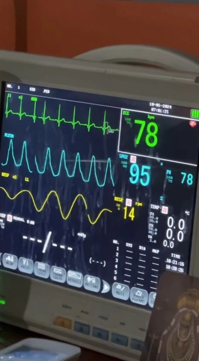 Monitorizare cardiacă EKG holter pacienți cronici București